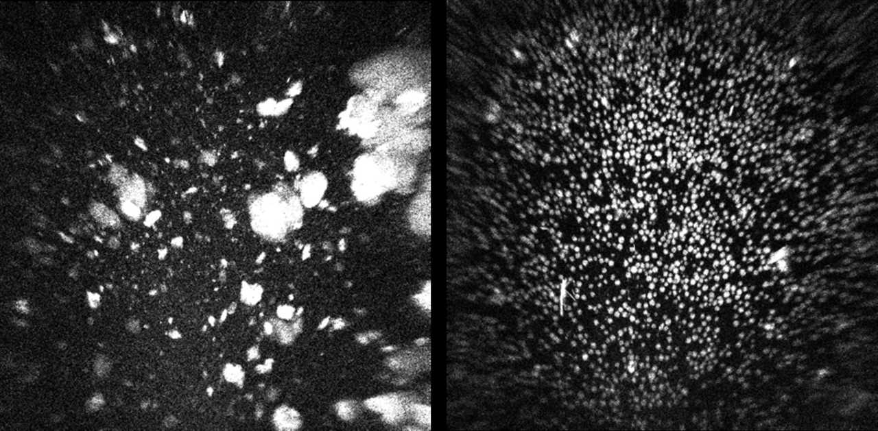 NASA's next moonshot: ending cancer